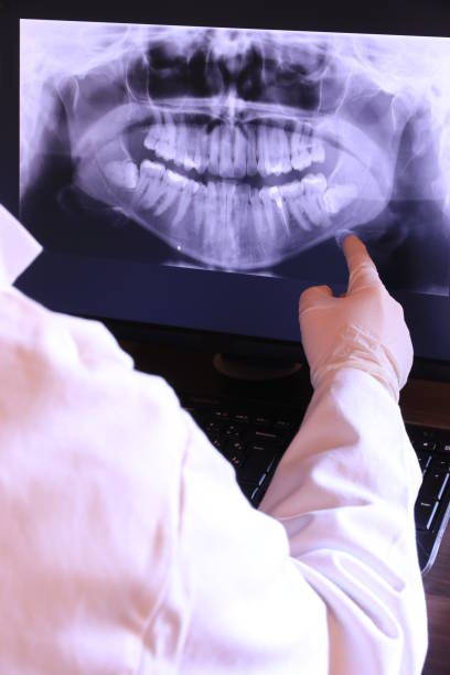 Best Broken or Chipped Tooth Repair in Hemet, CA