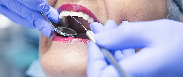 Best Emergency Treatment for Oral Infections in Hemet, CA